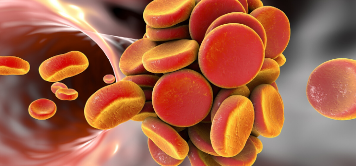 GeneProof Factor II Prothrombin PCR Kit